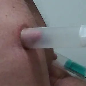 Nippel Galeriebild