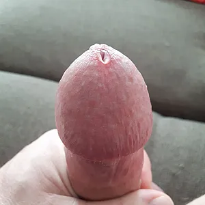 Precum / Lusttropfen Galeriebild
