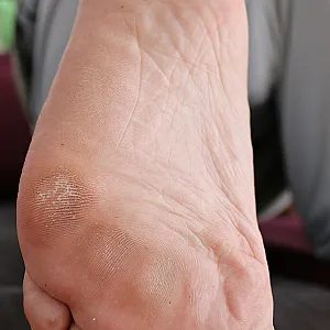 First image of asslover81's Gallery - My dirty feets