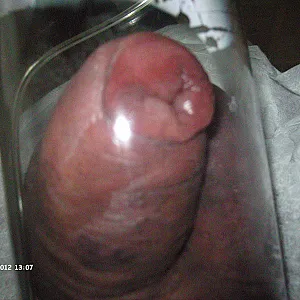 Das erste Bild von analgern's Galerie - für pumpfreunde