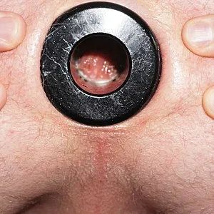 Horny at the morning gallery image