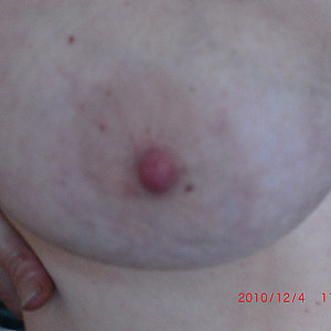 First image of schellie's Gallery - my fat tits