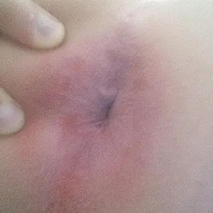 Nude gallery image