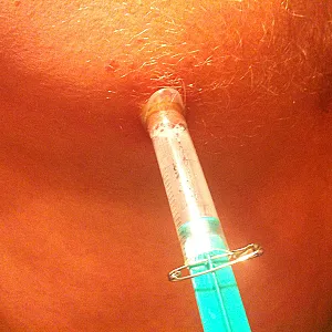Nipple-Games Galeriebild