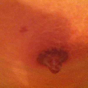 Nipple-Games Galeriebild