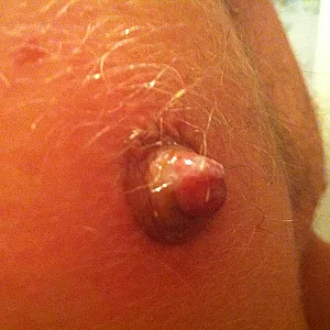 Nipple-Games Galeriebild