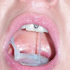 sperma total Galeriebild