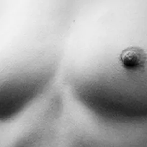Na sowas... Galeriebild