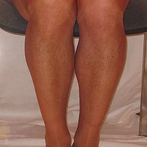 Fleischbeschau in Nylons Galeriebild