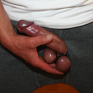 Ball pain gallery image