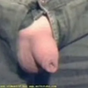 my foreskin gallery image