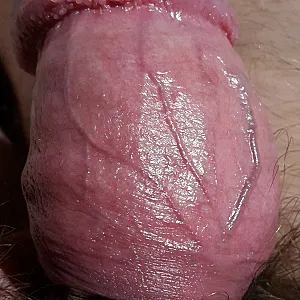 my cockrings gallery image
