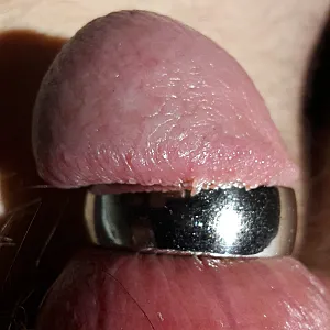 my cockrings gallery image