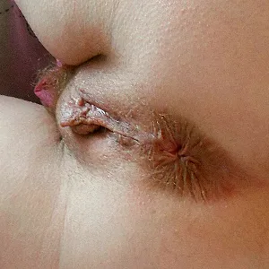 anal gallery image