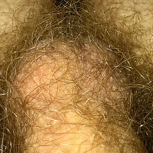 new unshaved gallery image