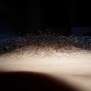 hairy gallery image