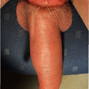 pumping gallery image