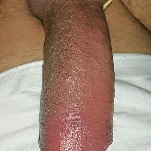 me gallery image
