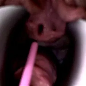 Dilatorspielchen Galeriebild