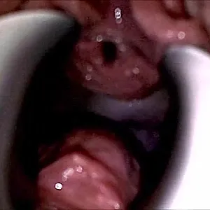 Dilatorspielchen Galeriebild