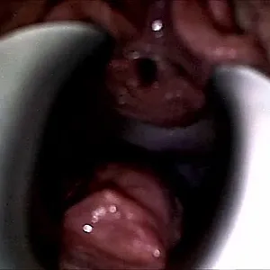 Dilatorspielchen Galeriebild