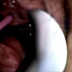 Dilatorspielchen Galeriebild
