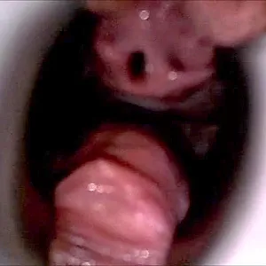 Dilatorspielchen Galeriebild