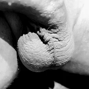 my dick gallery image