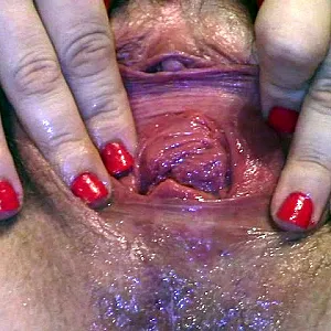 Haarige Fotze mit Speculum Galeriebild