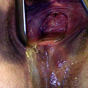 speculum pee gallery image