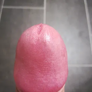 my dick gallery image