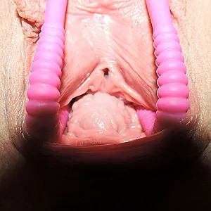 lipspreader in closeup gallery image