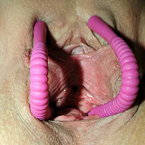 lipspreader in closeup gallery image