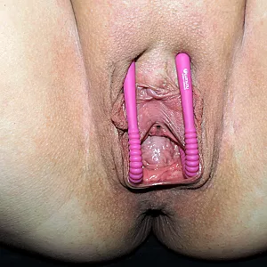 lipspreader in closeup gallery image