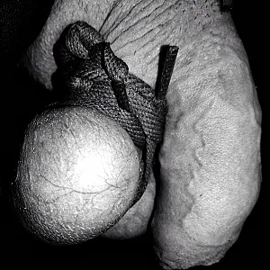 penis Galeriebild