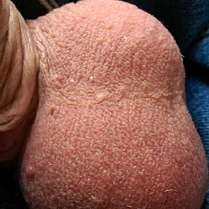 my cock and balls gallery image