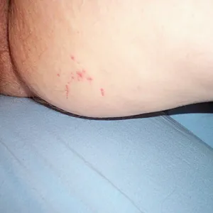 spanking gallery image