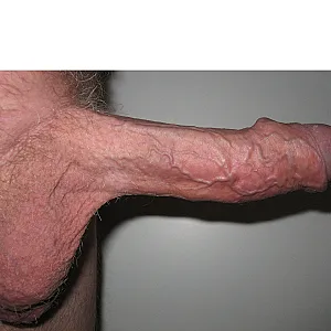 hard gallery image