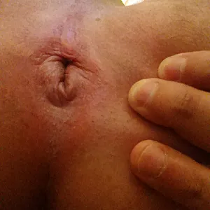 My hole gallery image