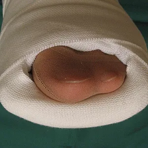 Horny with Short Leg Cast gallery image