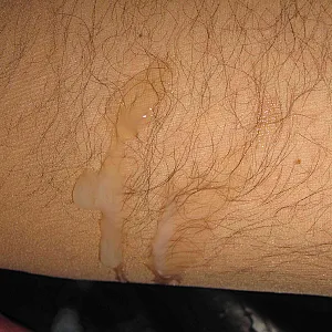 Horny with Short Leg Cast gallery image