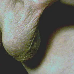 who wants ? gallery image