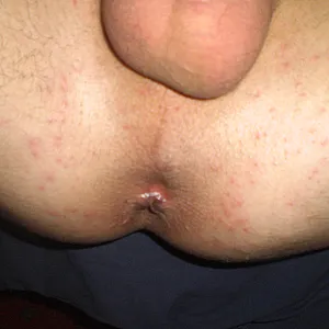 finger in the ass gallery image