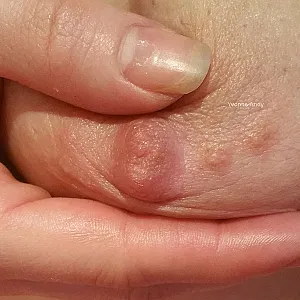 Hängebusen kann man schmusen Galeriebild