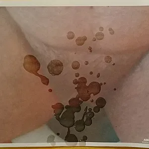 auf den Busch geklopft Galeriebild