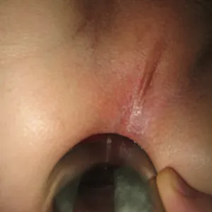 Flasche Anal Galeriebild
