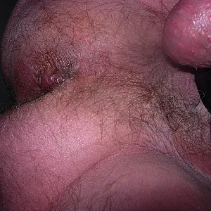 asshole gallery image