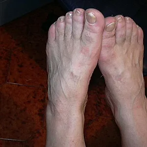 for Footlovers Galeriebild