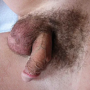 First image of Sackfan's Gallery - unshaved