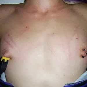 slave treatment gallery image